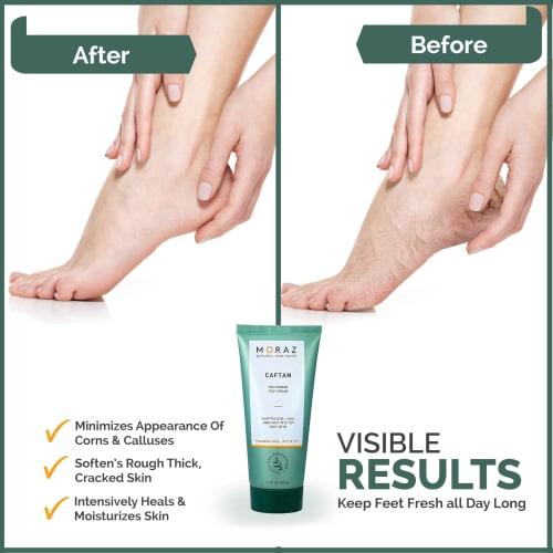 MORAZ Original Foot Cream, for Dry Heels and Feet, with Michianagi Extract, 100ml