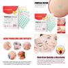 Jaysuing Love Heart Acne Patches Gentle Non Irritating Spot Treatment For Pimples