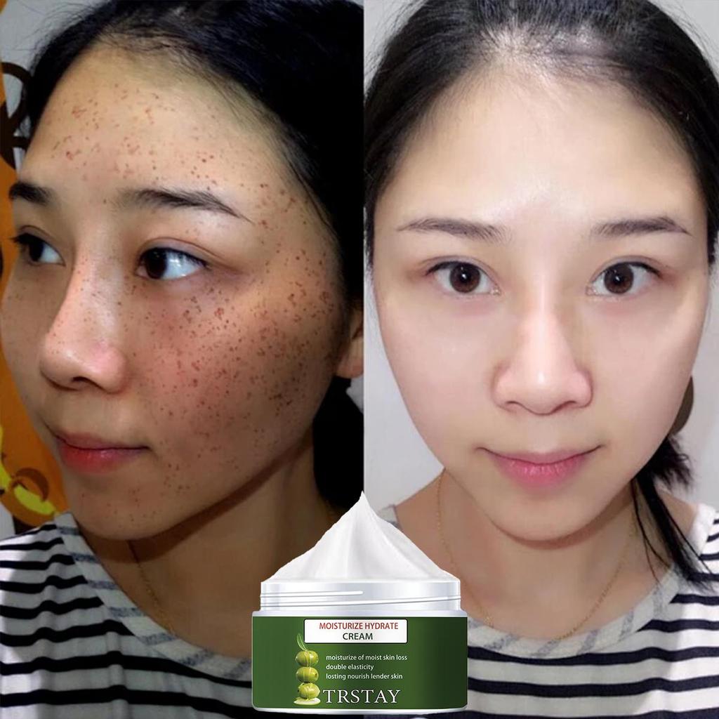 The translucent cream is gentle and non-irritating, firming the skin, brightening the complexion, reducing markings, hydrating and nourishing the skin