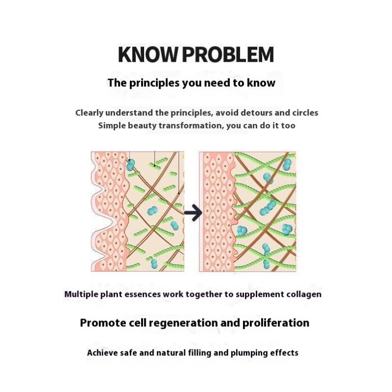 Fengying Elasmizing Essence Fills Apple Muscle Fengface Essence Huafeng Forehead Tear Groove Lifting