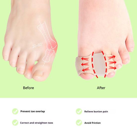6Pcs Toe Separators for Bunions Nylon Double Loop Toe Correctors Flexible Hallux Valgus Splint for Day Night Wear