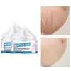 Pregnant Woman Stretch Mark Repair Cream Postpartum Repair and Fade Stretch Marks