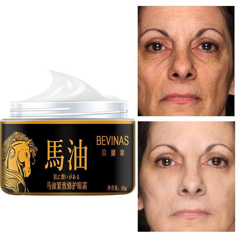 Most Effective Anti-Wrinkle Whitening Skin Care Horse Oil Cream Anti-aging,Anti-wrinkles Face Cream Eye Essence Remove Dark Circles Eye Cream