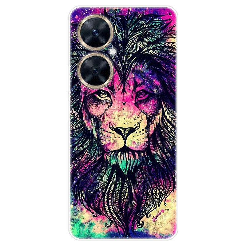 Für Huawei nova 11i nova11i Fall Weiche Silikon Zurück Abdeckung Cartoon Telefon Fall Diversifizierung