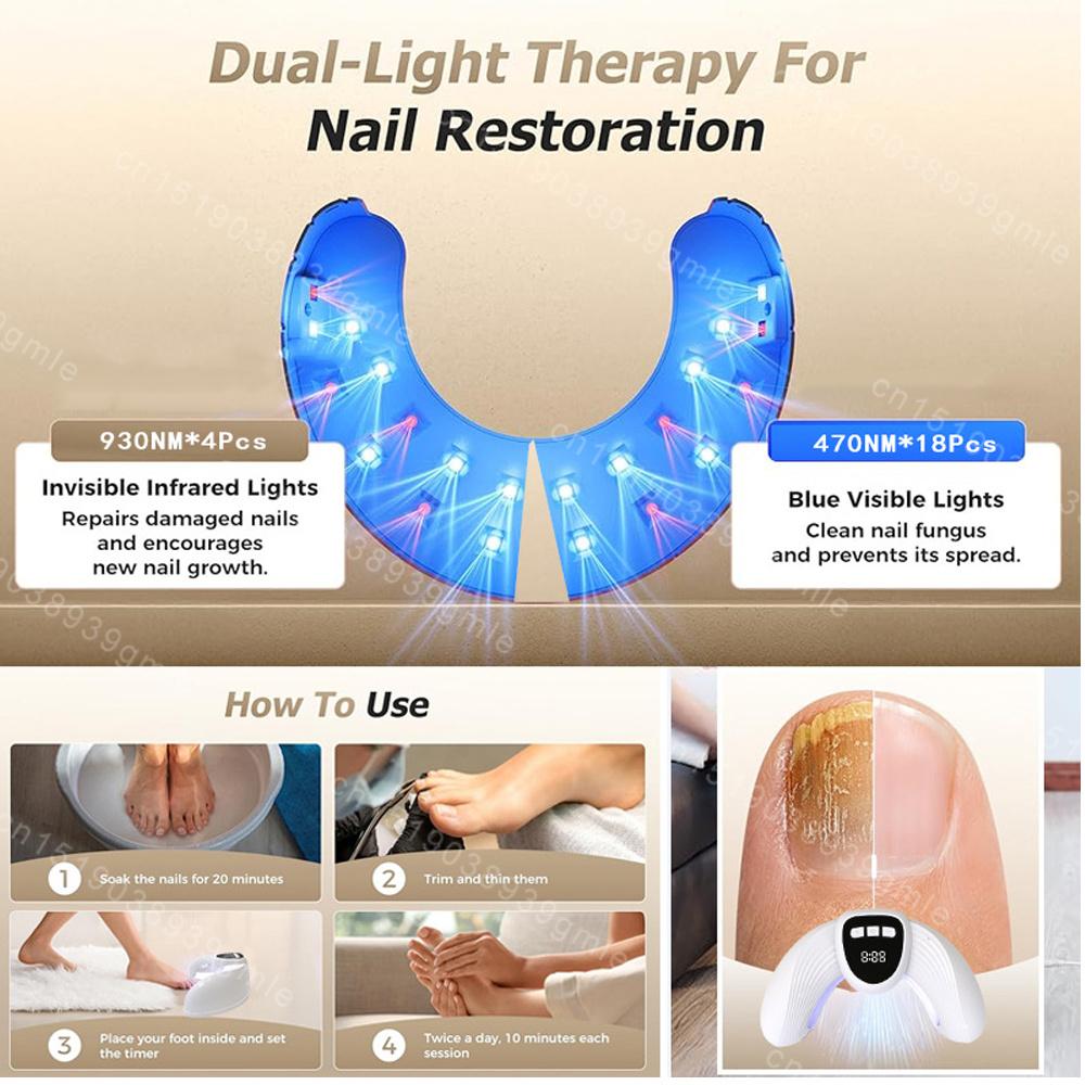Fungus Treatments Instrument Nail Fungus Laser Device Anti Infection Cure Machine Toenails Paronychia Onychomycosis Care
