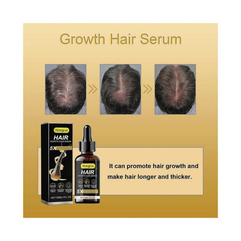 Rapid Hair Growth Serum, Hair Growth Hair Serum, Hair Growth Serum for Men and Women- Vegan Hair Growth Serum for Thinning Hair & Hair Loss
