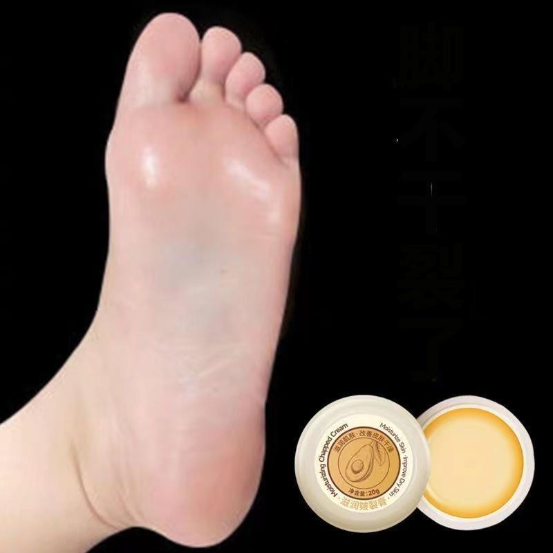 Anti-Riss-Fußcreme, rissige Haut, Reparaturcreme, Trockenheit, Ferse, rissige Peeling, Reparatur, Fußmaske, Lebensmittel, erweichen, feuchtigkeitsspendendes Lotin