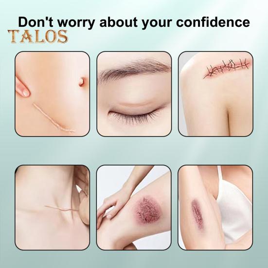 Silikon ärrarkblad Ärrtejp Rulle Professionella Mjuka Ärrremsor för Kirurgiska Ärr Keloider Akneärrbehandling Silikongelplåster