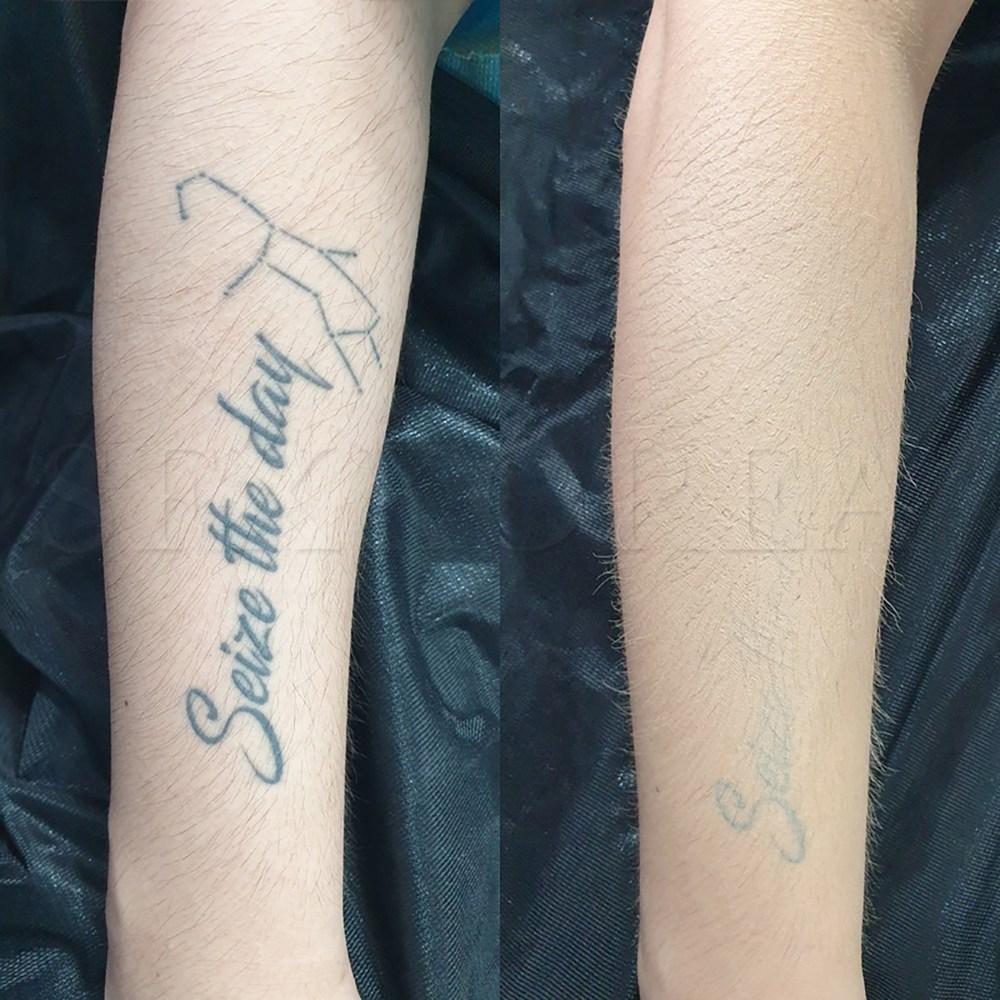 Tattoo cover, tattoo, vitiligo, scars, freckles, coffee spots, thin veins, blemishes concealer, SFX tattoo cover 1 set