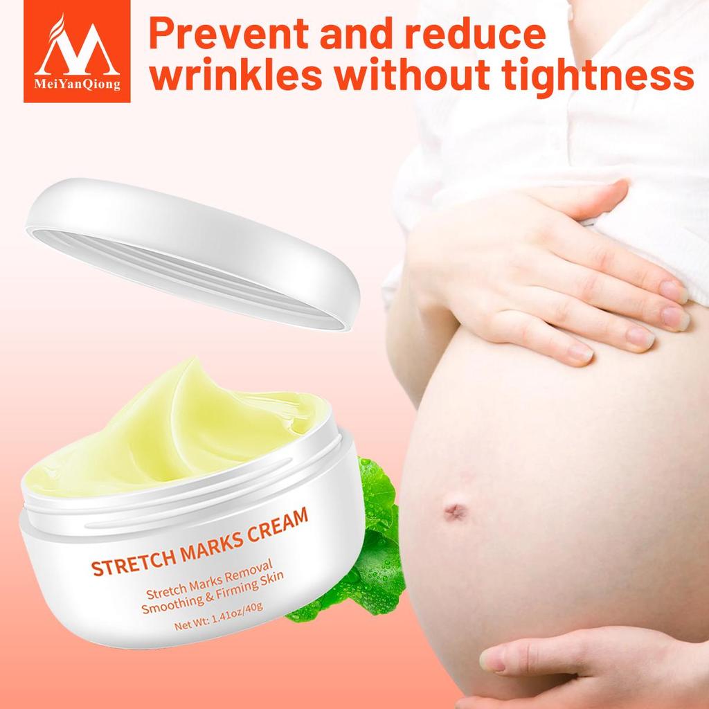 Revitalisierende Körpercreme gegen Dehnungsstreifen und Narben 35 g