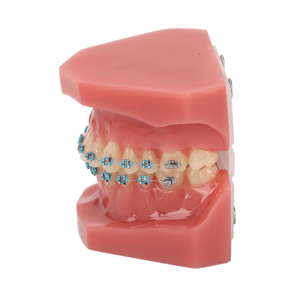 Zahnärztliches Kieferorthopädisches Modell 28 Zähne Harz Zahnärztliches Lehrmodell Zähne mit Metallbrackets