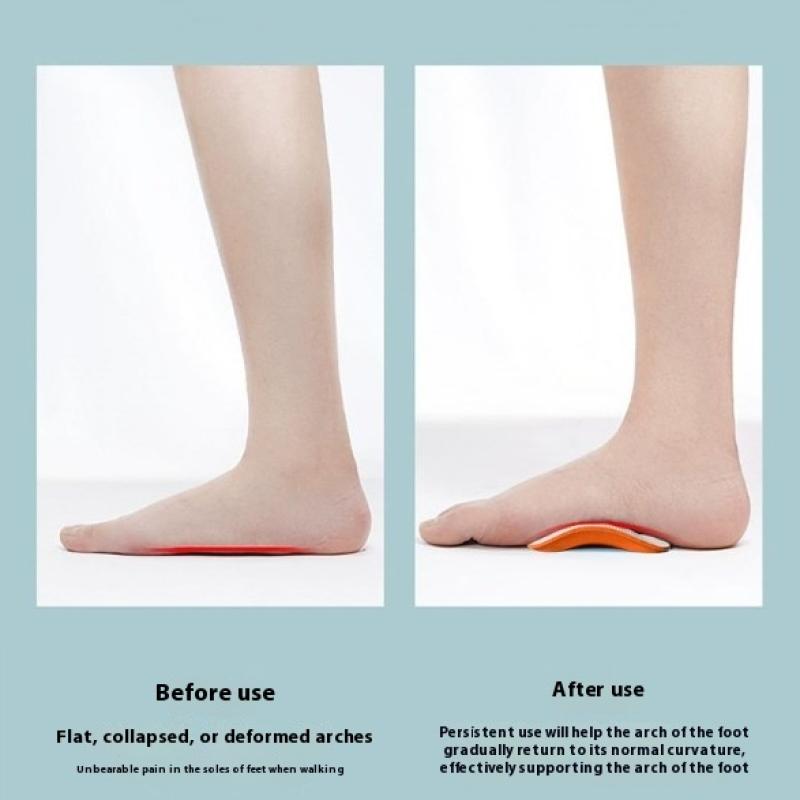1 pár pánske dámske športové vložky do topánok na hallux valgus a varus, vložky do topánok Eva, podpora klenby pre ploché nohy, ortopedické podložky do topánok