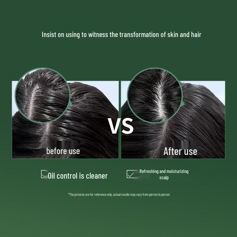 Shiseido Professional Adenovital Oil Control Shampoo