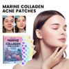 Cute Colorful Acne Patch for Cleaning Facial Acne and Pimples Multi-Shaped Portable Acne Patch