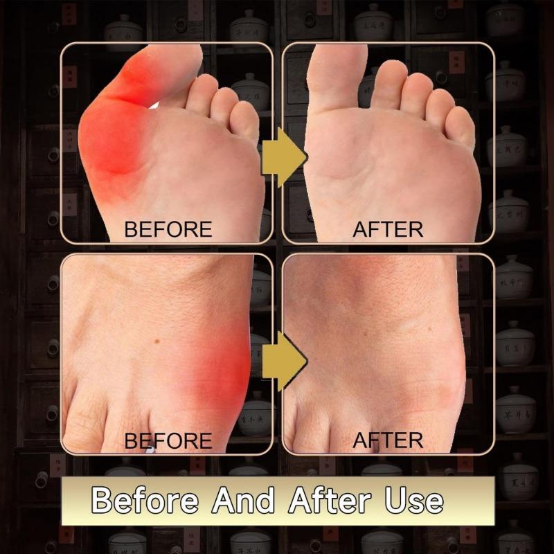 Heel Pain Patch Foot Plaster Pain Relief Patch Heel Bone Foot Care Herbal Patches