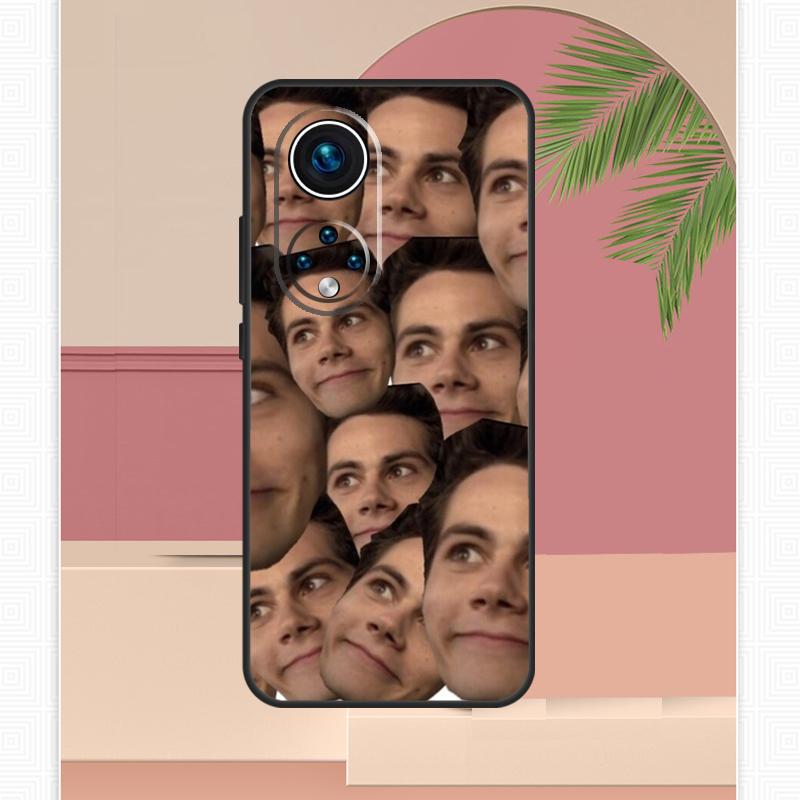 Dylan O'Brien Teen Wolf Case For Honor Magic 5 6 7 8 Pro Honor X9c X9b X9a X8b X8a X8c 50 70 90 400 200 Lite Cover
