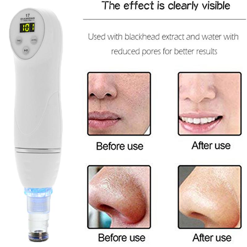 Diamond Dermabrasion Skin Peeling Beauty Machine Vacuum Blackhead Acne Remove Face Cleaning Facial Pore Cleaner Equipment