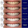 New Model Eelhoe Teeth Remove Teeth Tartar Stains Toba -8126696317719