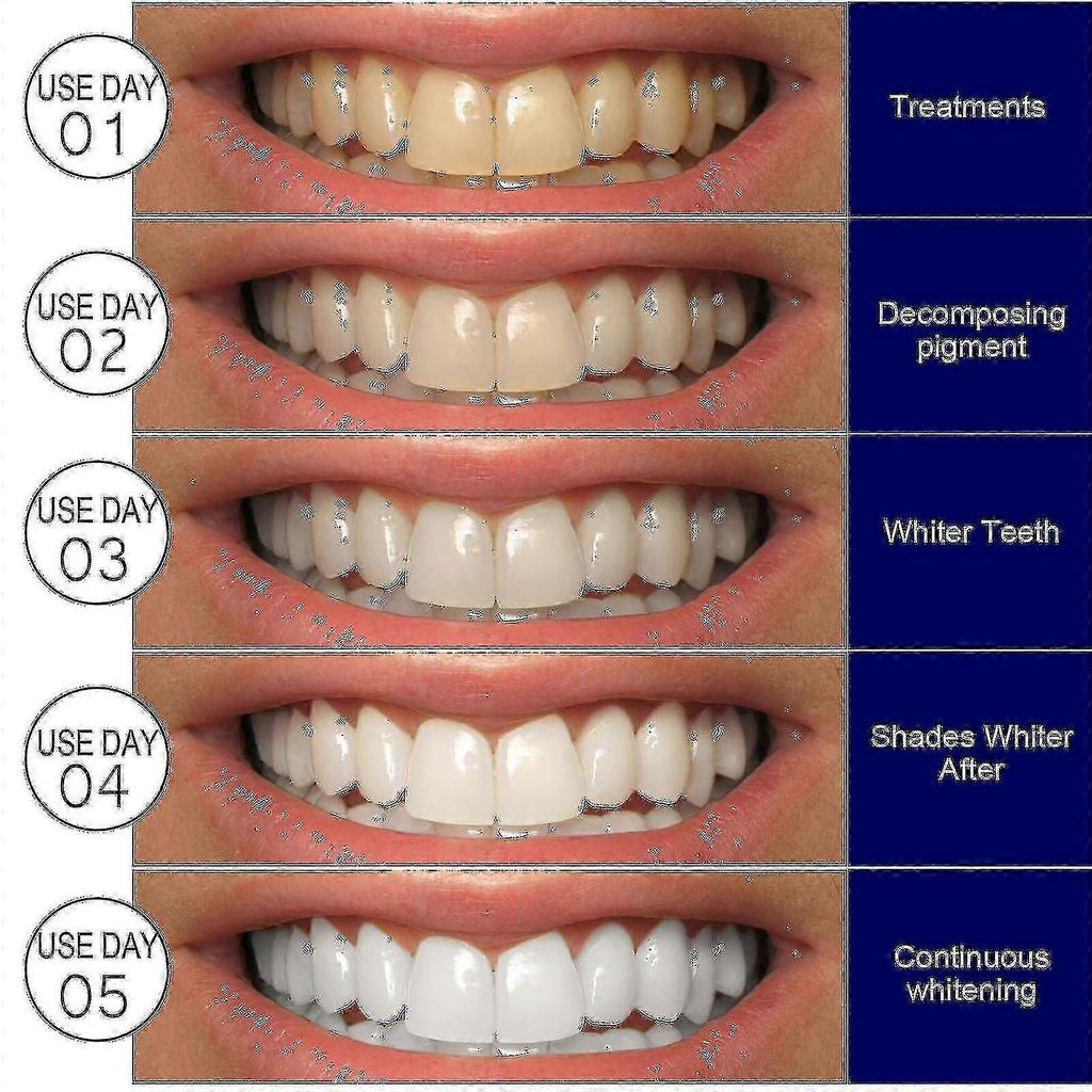New Model Eelhoe Teeth Remove Teeth Tartar Stains Toba -8126696317719