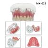 Model Dinti Implant Dentar Superior Inferior Model Dentar Transparent Punte Restorare Implant Dentar Amovibil Pentru Educație Predare Demonstrație