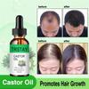 Biotin Fast Hair Growth Oil Serum do odrastania włosów Kuracja na przerzedzanie się włosów Płyn do wzrostu włosów Przeciw wypadaniu włosów dla kobiet i mężczyzn