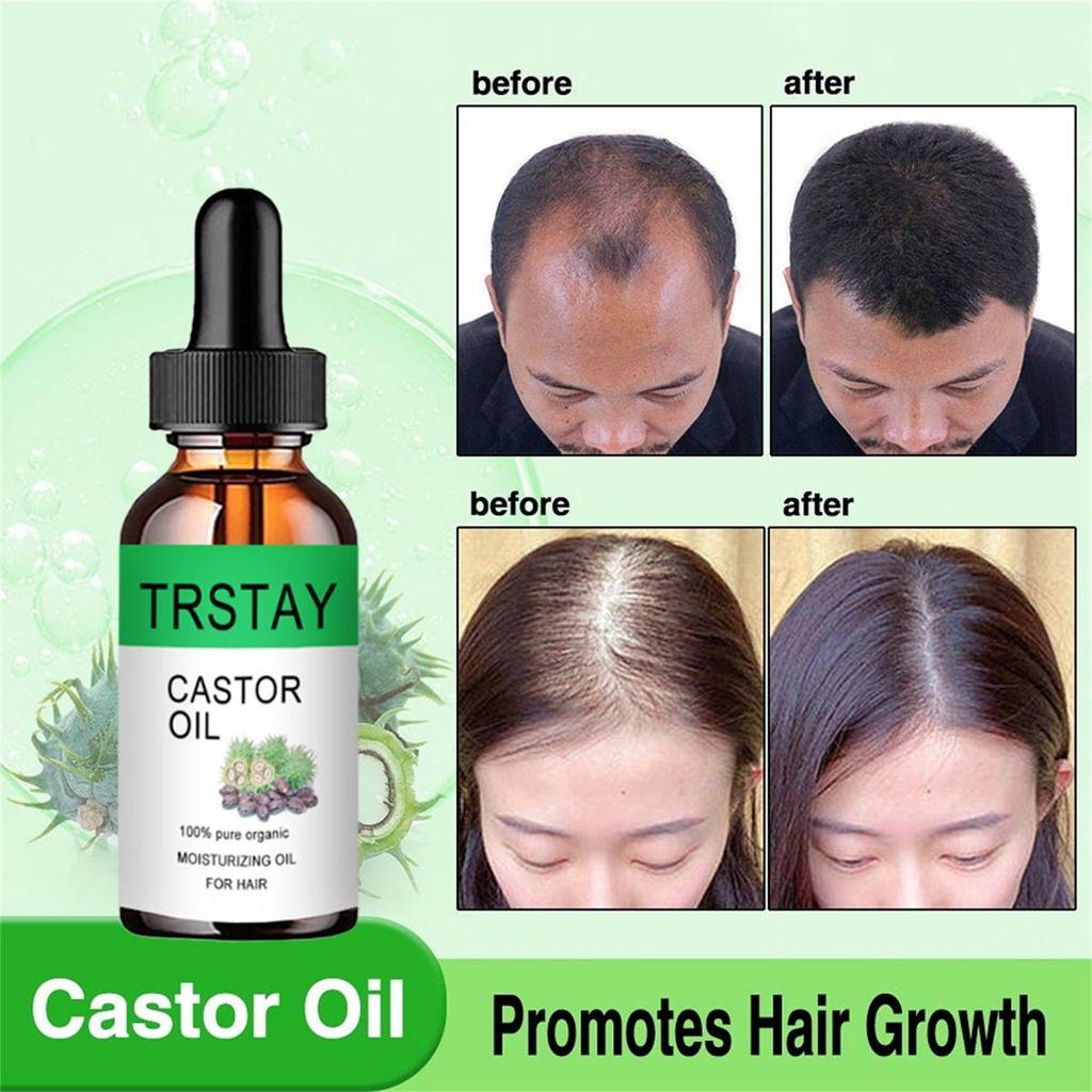 Biotin Fast Hair Growth Oil Serum do odrastania włosów Kuracja na przerzedzanie się włosów Płyn do wzrostu włosów Przeciw wypadaniu włosów dla kobiet i mężczyzn