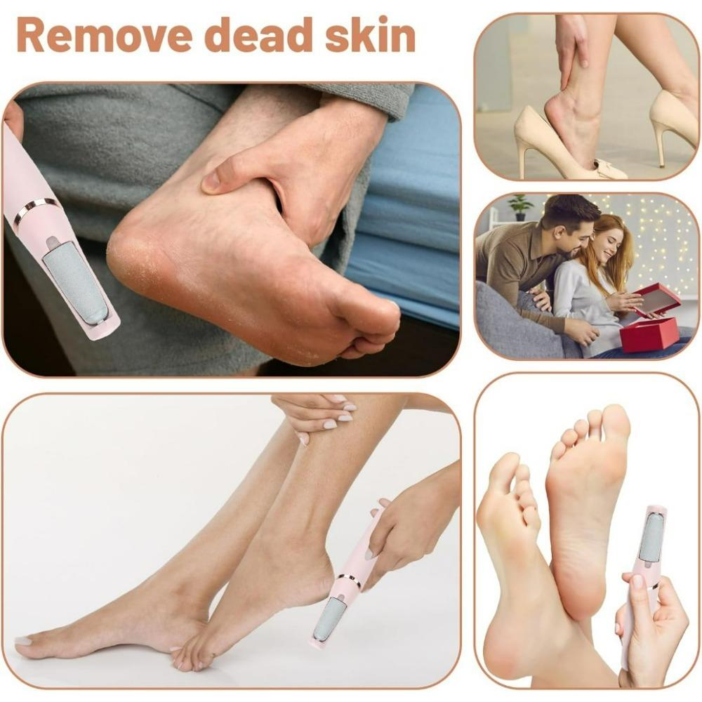 Electric Foot Callus Remover – USB Rechargeable Pedicure Tool with 2-Speed Roller and LED Light for Cracked Heels & Dead Skin