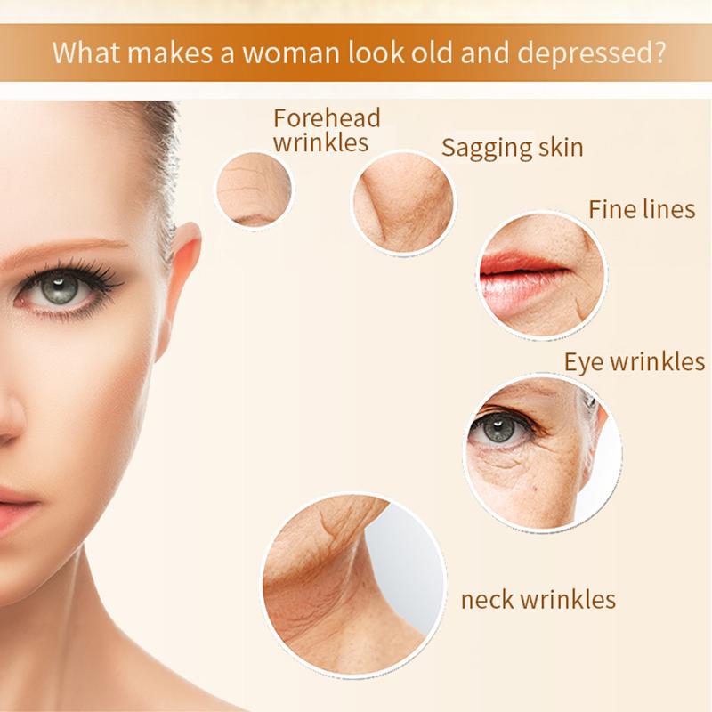 

CM-5-RF Radio Frequency Skin Tightening Firming Machine Microcurrent Facial Device Wrinkles Facial Toning Tool Rose Gold