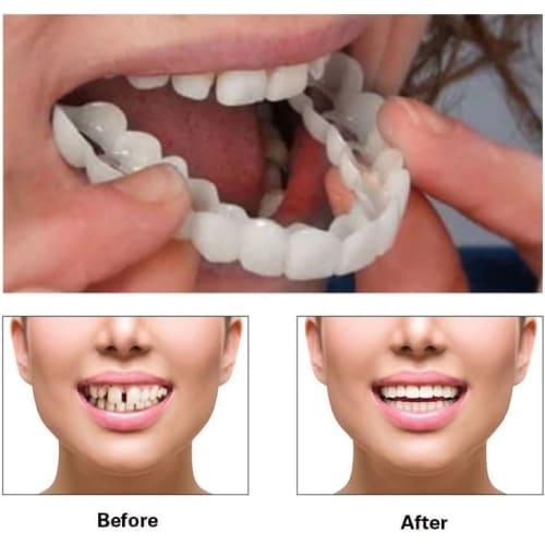 2 Pairs of Dentures, False Teeth, Natural and Comfortable Fit, Smile Now with Comfortable Fit - Matching Upper and Lower Sets, Men's and Women's Insta