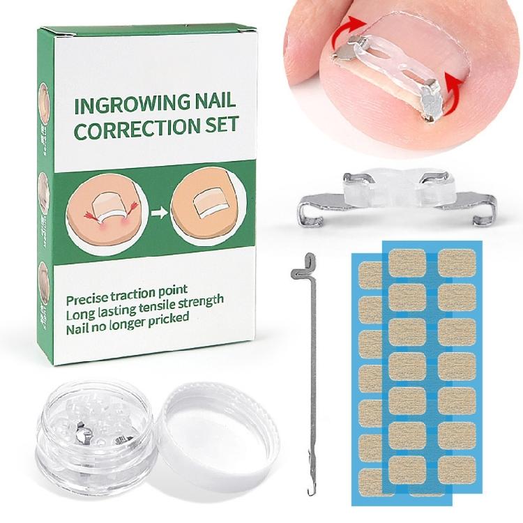 Stainless Steel Lever Hook Ingrowns Toenail Tool Elastic Bands Adjustable Corrector For Men And Women