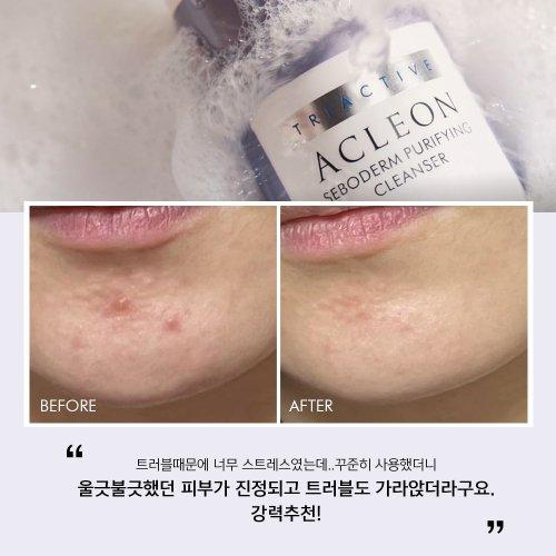 Acleon Anasis Mildly Alkaline Mildly Acidic Foam Cleansing 200ml