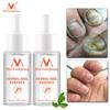 Remedy for Toenail Fungus / Antifungal Drops