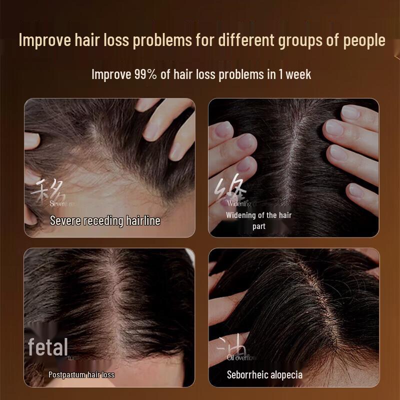 RUYI Anti-Hair Loss Hair Growth Shampoo