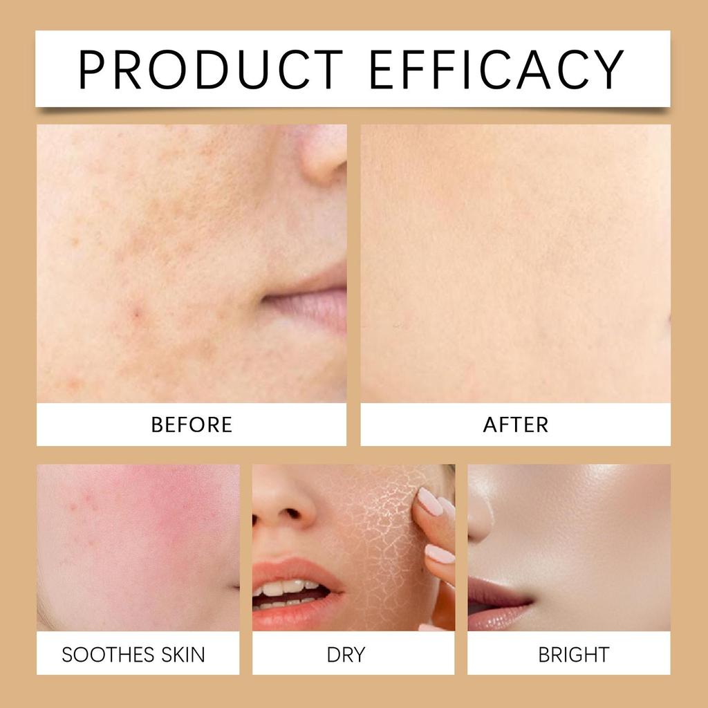 Hoygi Brightening Essence 30ml Multi-functional formula reduces fine lines and brightens skin, balances oil and moisture while refining pores.