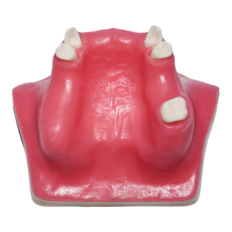 Maxillary Sinus Lift Dental Implant Model Practice Model for Oral Surgery Teaching Doctor-Patient Communication Demonstration