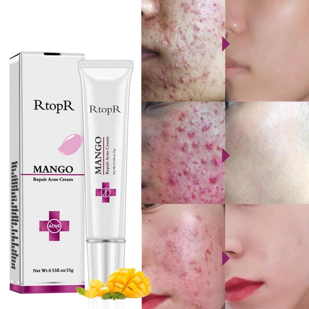 skin care cream price