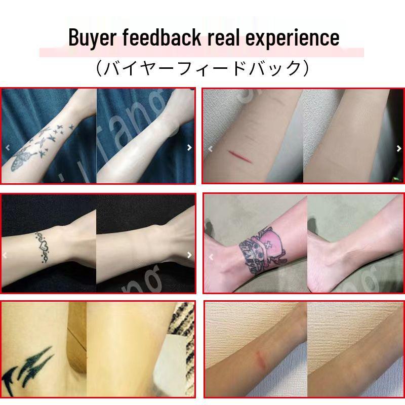 Nude Waterproof Tattoo Concealer Patch - Long-Lasting Scar, Vitiligo, and Birthmark Cover-Up