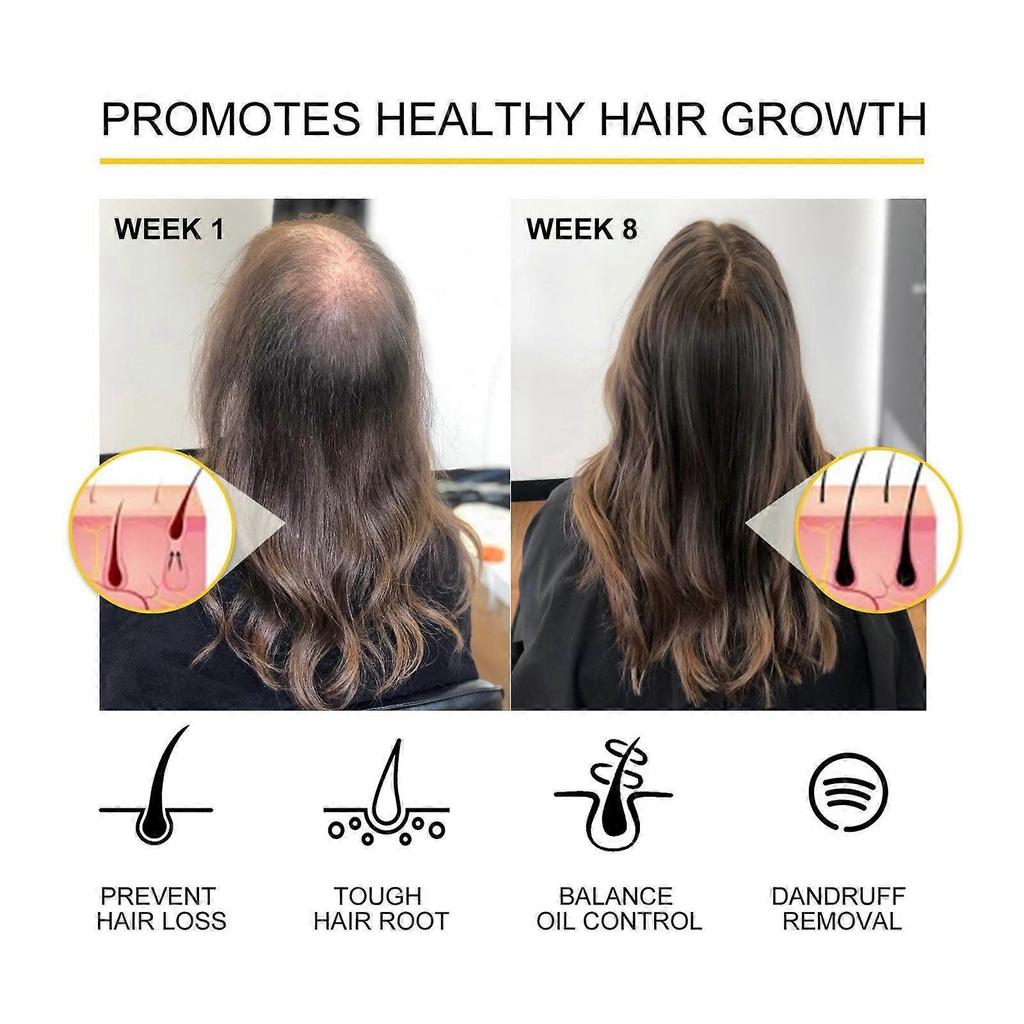 Nourishing hair essential oil, thick hair, repairing hair roots, damaged hair