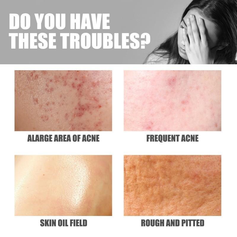 Jaysuing Butt Care Cream Nourishing Moisturizing Formula For Clear And Smooth Skin