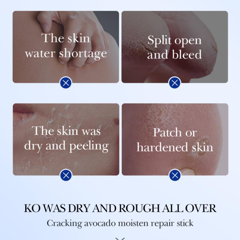 Vaseline Avocado Moisturizing Stick 40g SADOER Anti-Dry and Cracked Foot Cream