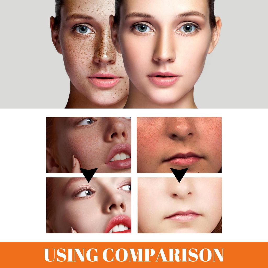 EELHOE Papaya Whitening Freckle Cream lightens freckles and dark spots, brightens and moisturizes the skin.