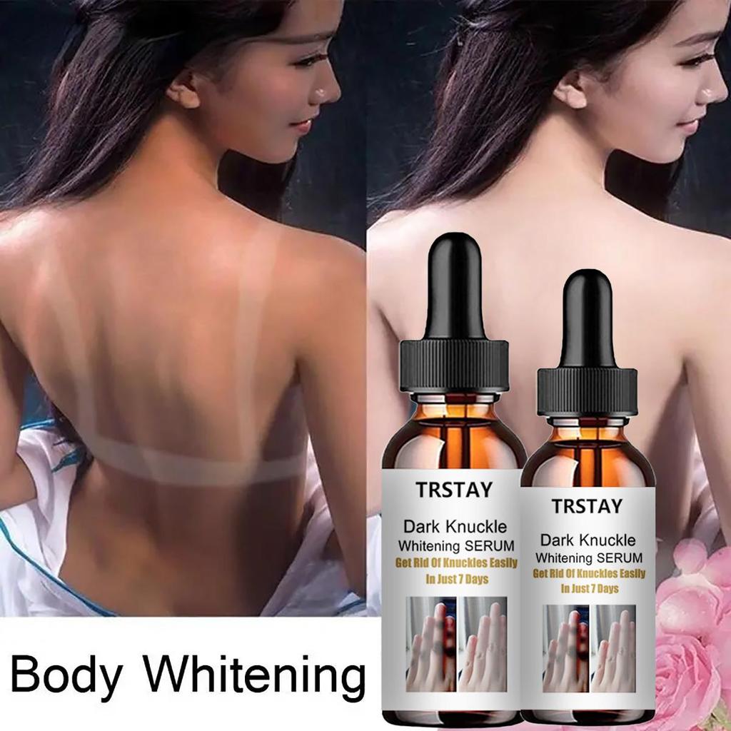 Anti Black Knee and Elbow Glow Cream Removes Dullness, Brightens Skin Tone, Moisturizes and Moisturizes