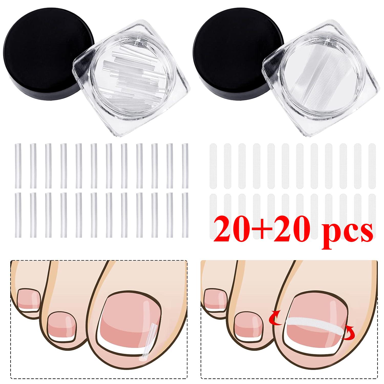 

Корректор вросшего ногтя Полоски Ноготь Коррекция Ногтя Корректор Зажим Для Коррекции Выпрямление Ногтя Восстанавливающий Пластырь Корректор Изогнутого Ногтя 2 Стили 20pcs+20pcs