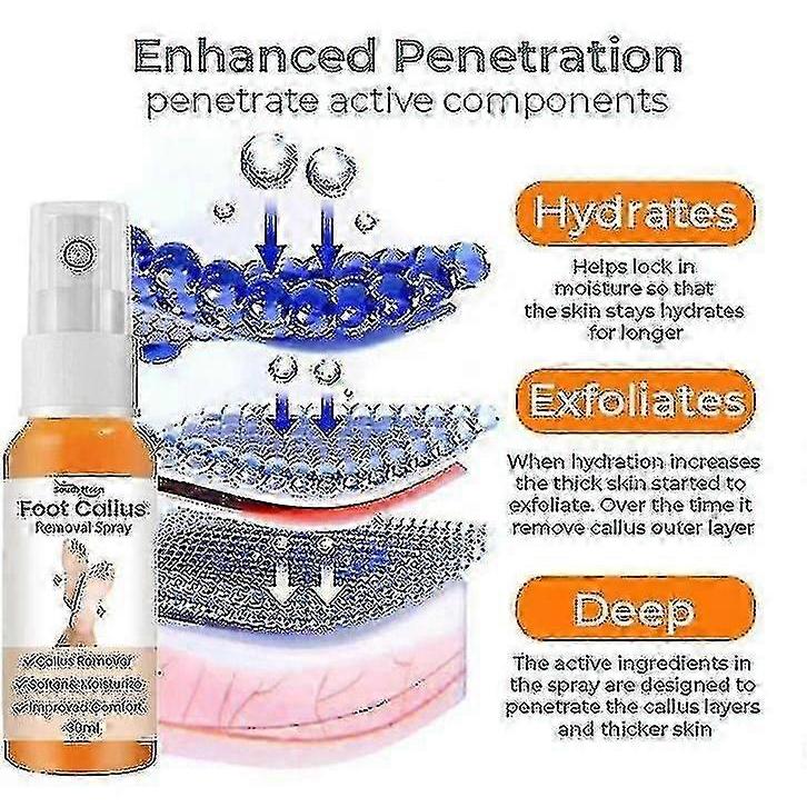 South Moon Foot Exfoliator Spray Pedicure Exfoliator 30ml