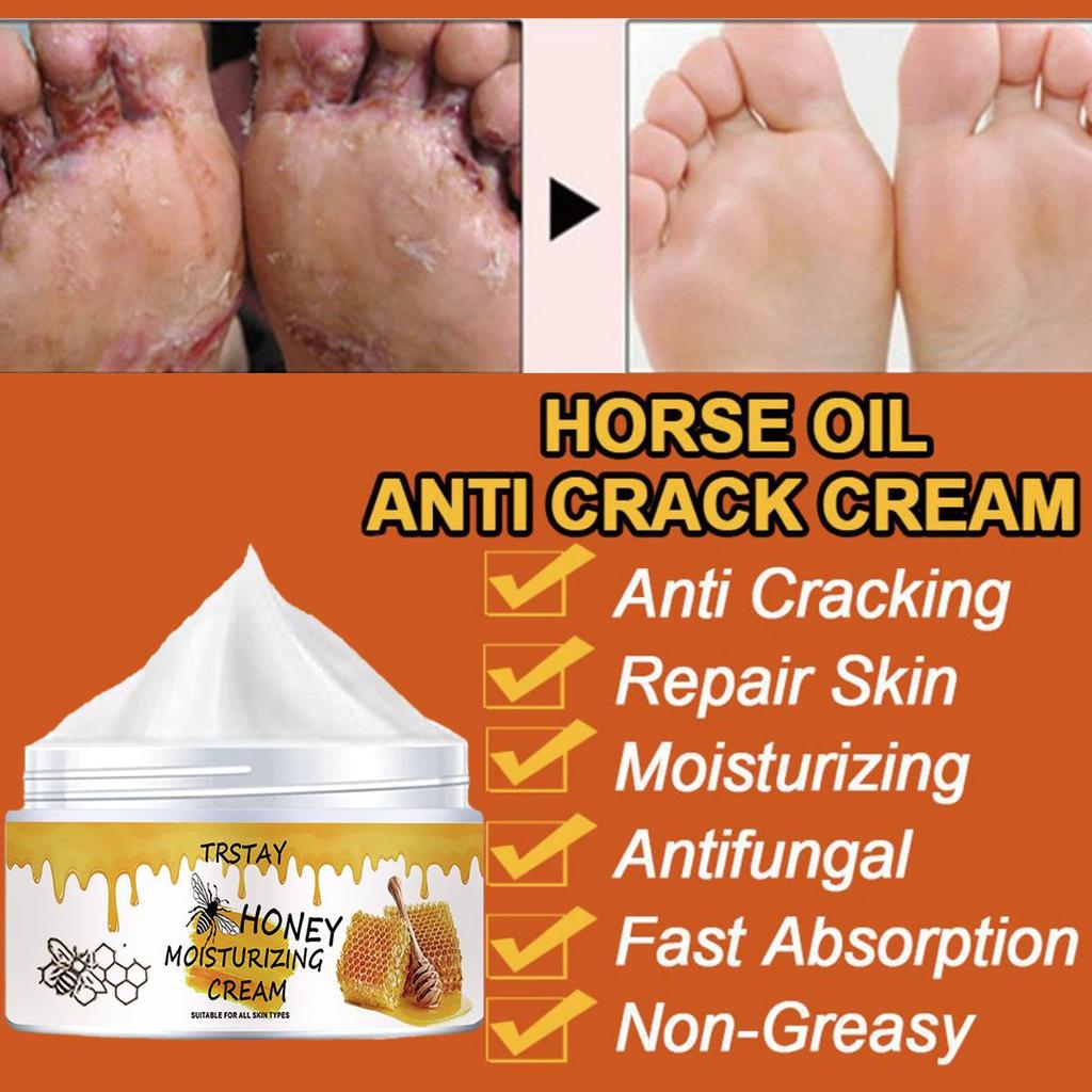 Chapped Hands and Feet Repair Cream, Moisturize, Nourish the Skin, and Leave the Skin Soft and Delicate