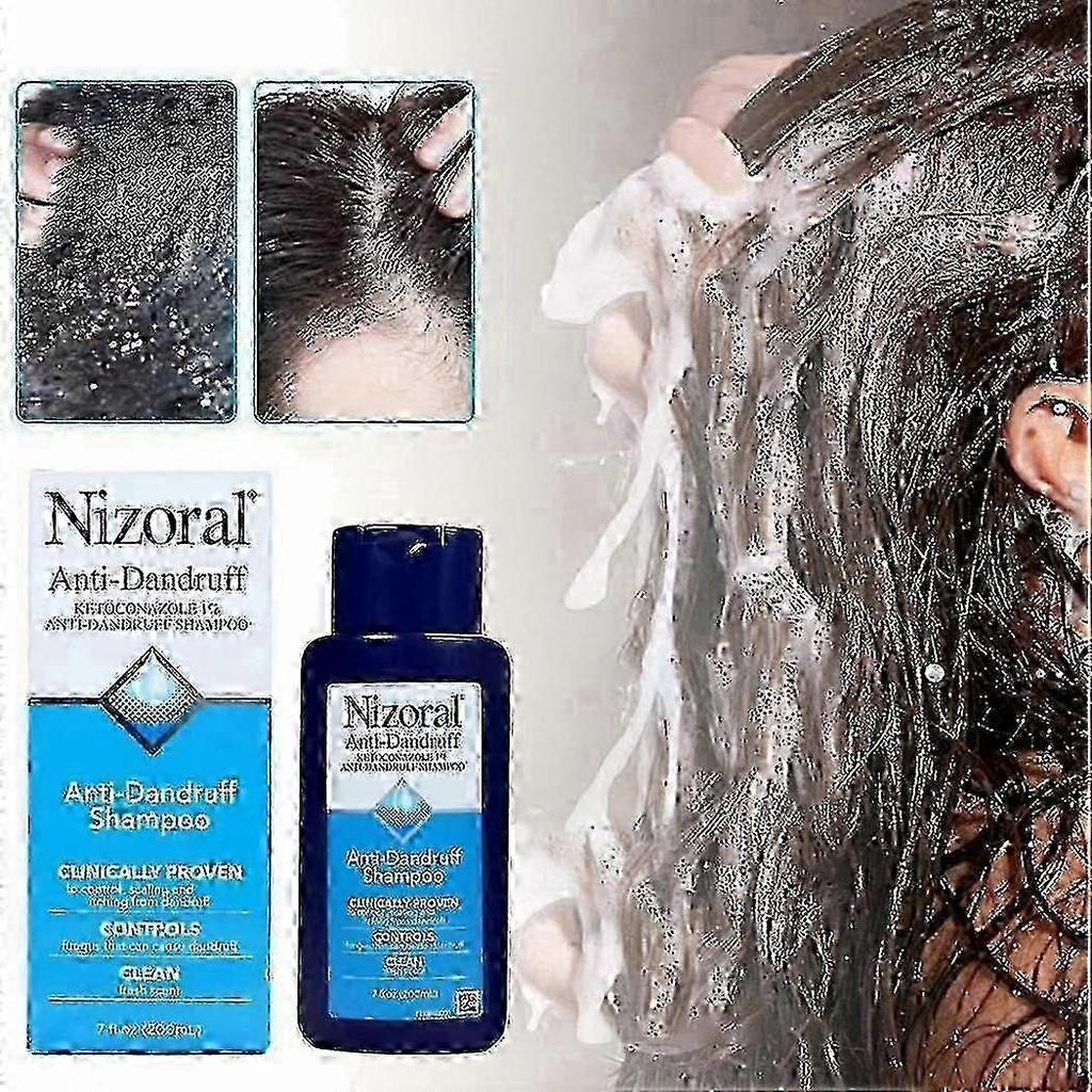 2025 Nizoral Shampoo for Dandruff 7 Fl Oz 200ml EXP