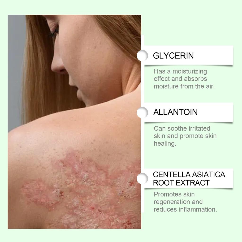 Herbal Skin Soothing Cream Nourishing Skin Discomfort Topical Body Skin Care Cream