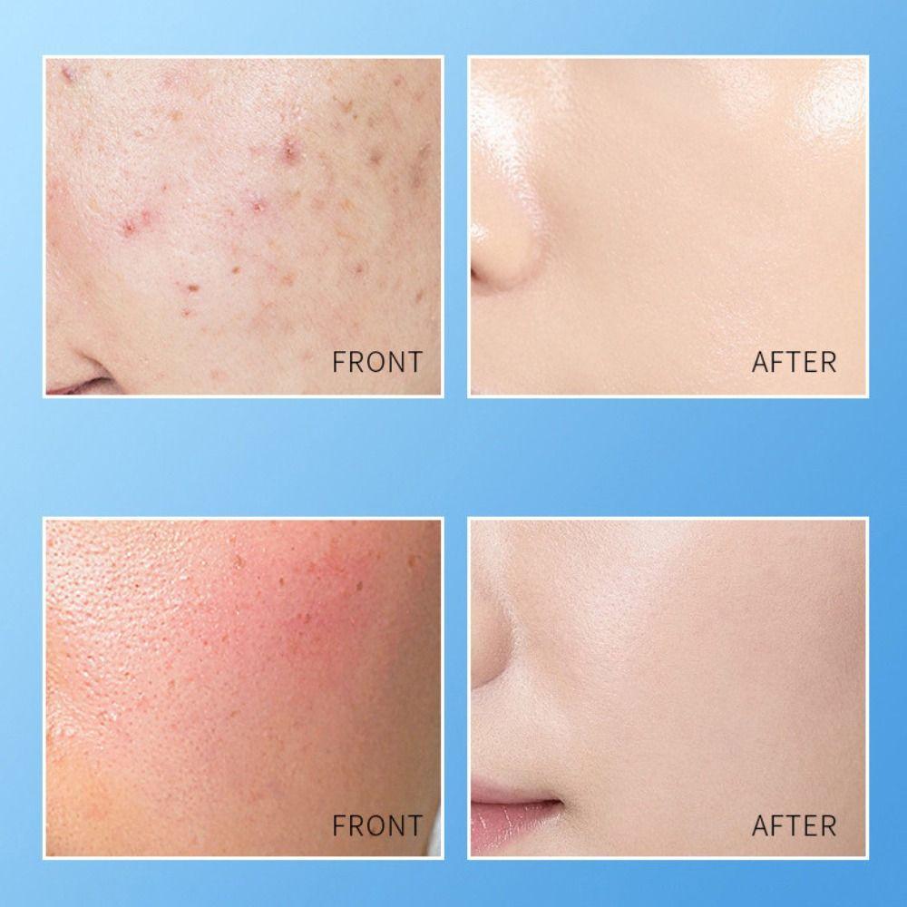 White Effect Face Cream 80g Soothing Moisturizing B5 Cream Lightening Acne