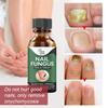 50ML Nail Treatment Solution Nail Repair Liquid Accelerate Metabolism Onychomycosis Treatment