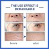 3pcs Anti-Aging Serum,Botoxlux Face Serum Collagen Boost Anti-Wrinkle Serum for Women&Men,Fade Fine Lines Essence_lsmpk